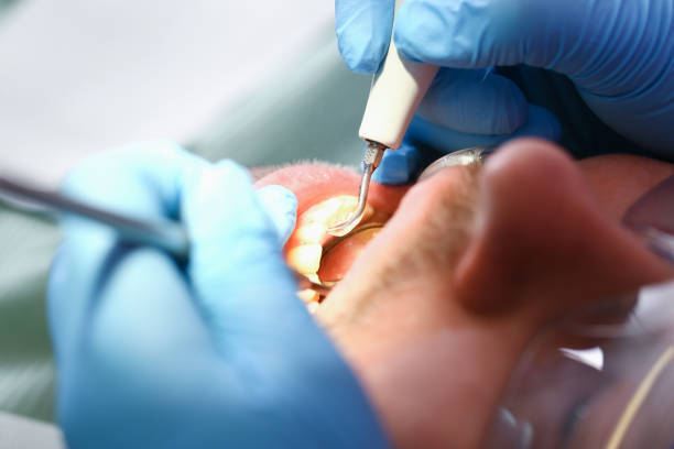 Best Emergency Dental Services for Seniors in Riverdale, IL