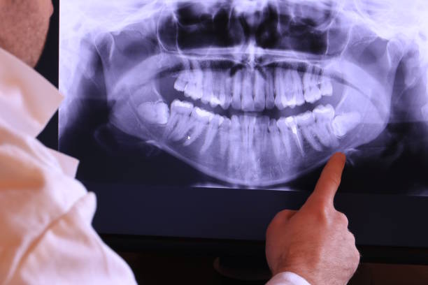 Best Emergency Dentist for Special Needs Patients in Riverdale, IL