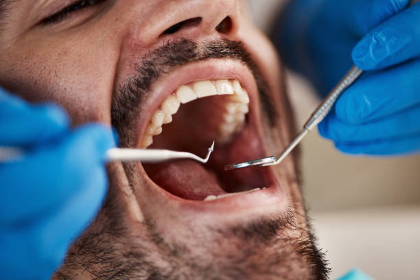 Best Emergency Dentist for Special Needs Patients in Riverdale, IL